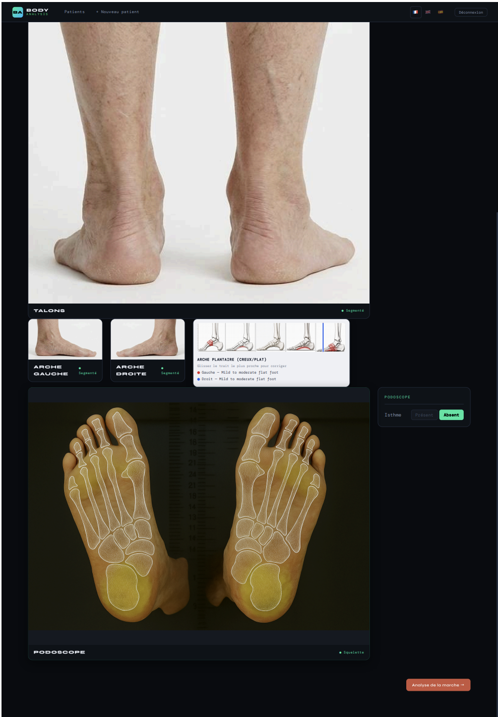 Janine foot analysis